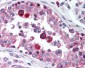 HAVCR1 / KIM-1 Antibody (N-Terminus)