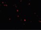 IFIH1 / MDA5 Antibody (C-Terminus)