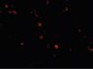 IFIH1 / MDA5 Antibody (C-Terminus)