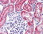 IFIH1 / MDA5 Antibody (C-Terminus)
