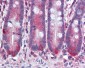 MMP11 Antibody (clone SL3.05)