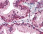 EGFR Antibody (Internal)