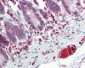 TLR7 Antibody (aa706-728)