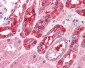 TRIM1 / MID2 Antibody (C-Terminus)