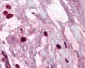 TPSAB1 / Mast Cell Tryptase Antibody (clone AA1)