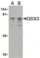 DDX3 / DDX3X Antibody (N-Terminus)