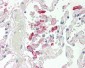 Carboxylesterase 1 / CES1 Antibody (Internal)
