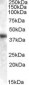 Aspartate Aminotransferase Antibody (aa157-167)