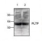 PLTP Antibody