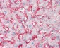 SLC2A2 / GLUT2 Antibody