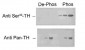 TH / Tyrosine Hydroxylase Antibody (phospho-Ser40)