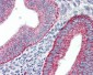 HAVCR1 / KIM-1 Antibody (Internal)