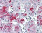 PLIN3 / M6PRBP1 / TIP47 Antibody (N-Terminus)