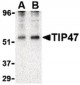 PLIN3 / M6PRBP1 / TIP47 Antibody (N-Terminus)