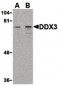 DDX3 / DDX3X Antibody (Internal)