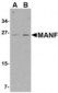 MANF / ARMET Antibody (C-Terminus)