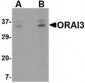 ORAI3 Antibody (C-Terminus)