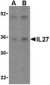 IL27 Antibody (Internal)