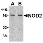 NOD2 / CARD15 Antibody (C-Terminus)