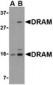 DRAM1 / DRAM Antibody (C-Terminus)