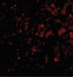 DRAM1 / DRAM Antibody (N-Terminus)