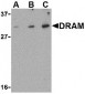 DRAM1 / DRAM Antibody (N-Terminus)