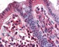 TNFRSF17 / BCMA Antibody (C-Terminus)