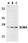 TNFRSF17 / BCMA Antibody (C-Terminus)