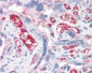 IL18 Antibody