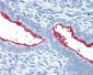 MUC16 / CA125 Antibody (clone X306)