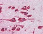 MAOB / Monoamine Oxidase B Antibody (Internal)