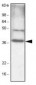 C/EBP Beta / CEBPB Antibody (clone 47A1)