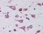 CTSD / Cathepsin D Antibody (clone 4G2)
