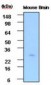 PSPH Antibody (aa1-225, clone 3G12)