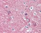HK1 / Hexokinase 1 Antibody (aa1-917, clone 4D7)