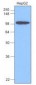 HK1 / Hexokinase 1 Antibody (aa1-917, clone 4D7)
