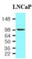 FOLH1 / PSMA Antibody (aa117-351, clone K1H7)