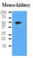 PDPN / Podoplanin Antibody (aa1-206, clone 5E2)