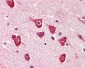 PPM1G Antibody (aa317-546, clone K1G6)