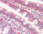 CFL1 / Cofilin Antibody (aa1-166, clone AT1C1)