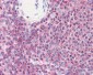 CFL1 / Cofilin Antibody (aa1-166, clone AT1C1)