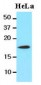 CFL1 / Cofilin Antibody (aa1-166, clone AT1C1)