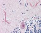 FOXC1 Antibody (C-Terminus)