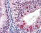 FANCG Antibody (C-Terminus)
