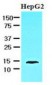 FABP1 / L-FABP Antibody (aa1-127, clone 2G4)