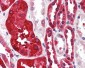 Ferritin Heavy Chain / FTH1 Antibody (C-Terminus)