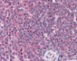 CARMA1 / CARD11 Antibody (C-Terminus)