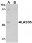 LASS5 Antibody (C-Terminus)
