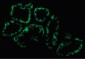 ACE2 / ACE-2 Antibody (Internal)