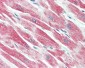 BECN1 / Beclin-1 Antibody (C-Terminus)